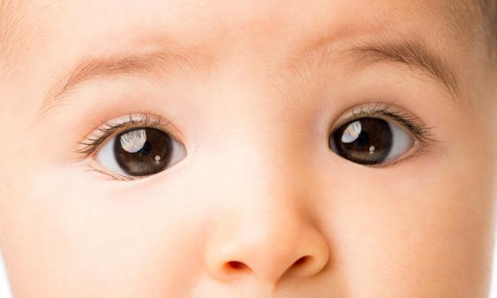 Strabismus Cuases, Diagnosis, Treatment and Cost Medmonks